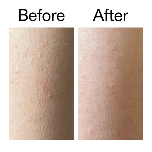 Glycolic Acid Exfoliating Body Stick